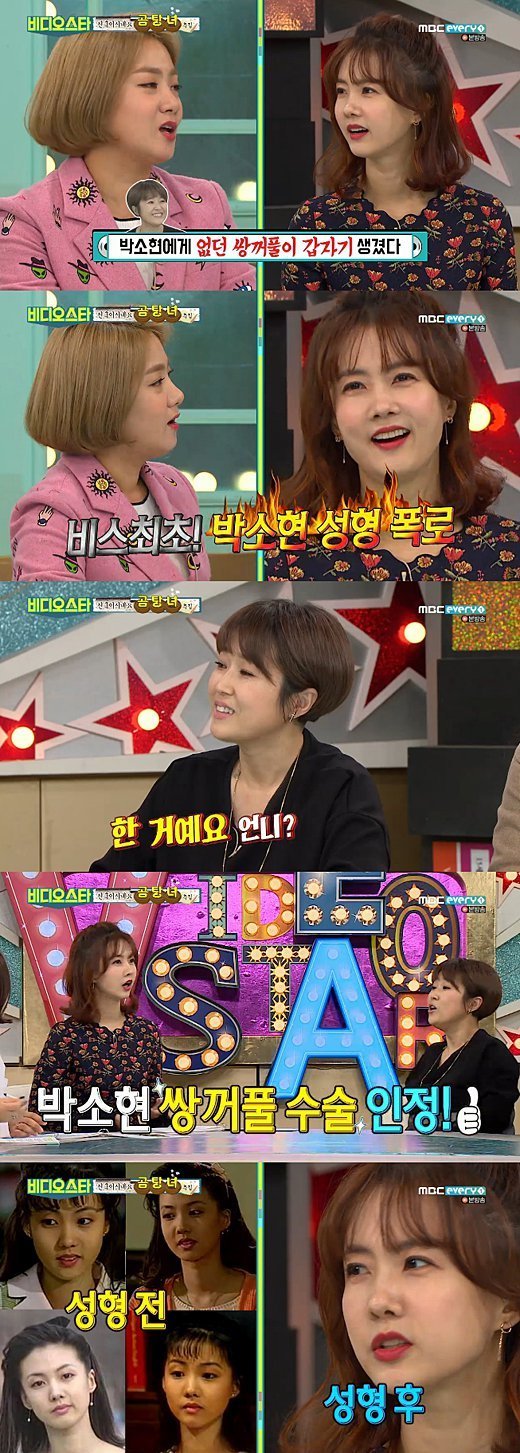 박소현 성형 전후