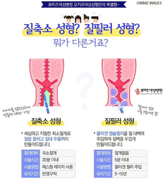 요즘 2~30대 여자가 많이 받는 시술
