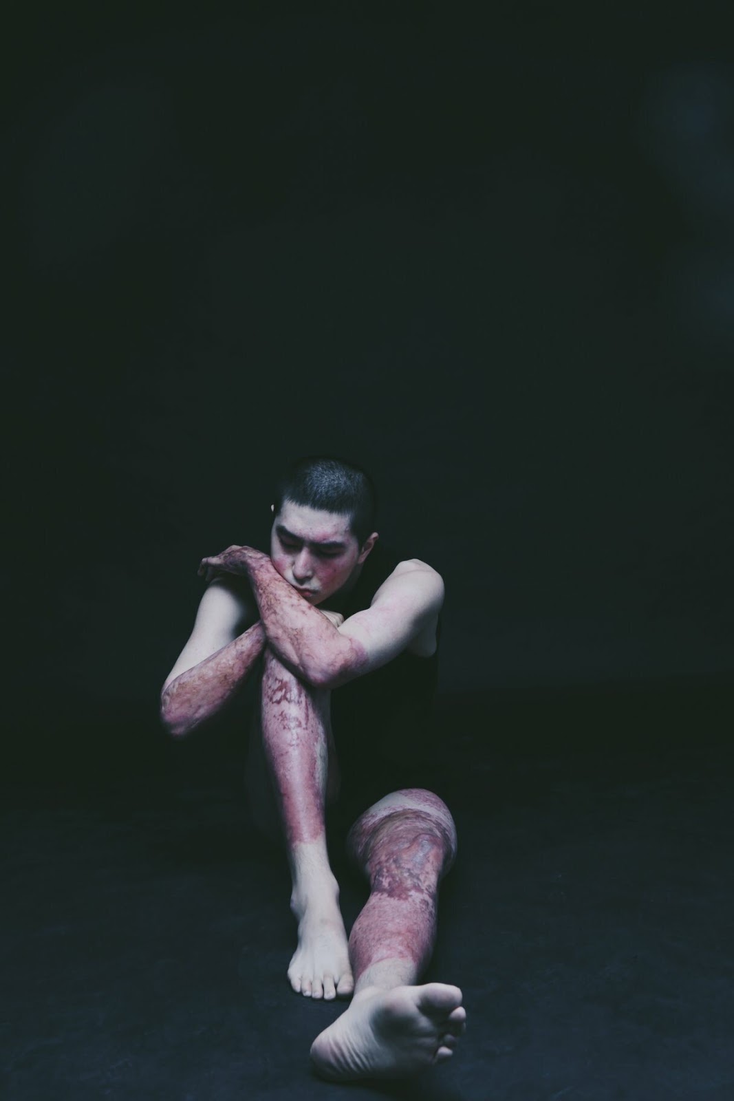 군인 시절 전신화상 입은 남성이 삶을 사는 방식